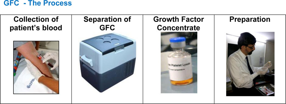 Feet First | Platelet-rich plasma (PRP) / Growth Factor Concentrate (GFC)
