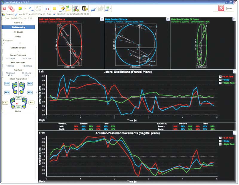 09_Stabilometry