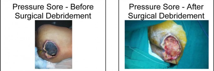 Surgical-Treatments-1-683x229
