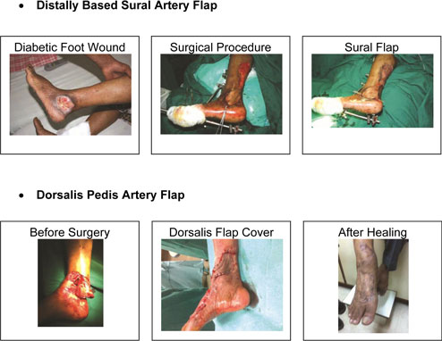 Surgical-Treatments-3